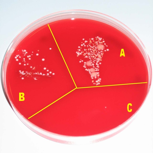 Illustrasjon: Eksempel på bakterieprøve
